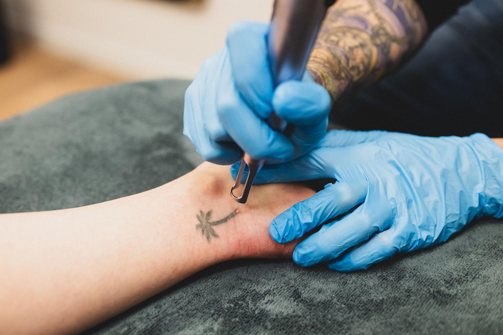 li8 3610 lilian fotografie second skin tattoo remolval leiden daan 2026 02 02