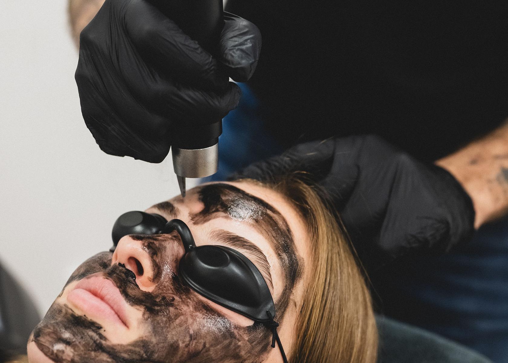 li8 3916 lilian fotografie second skin tattoo remolval leiden daan 2026 02 02