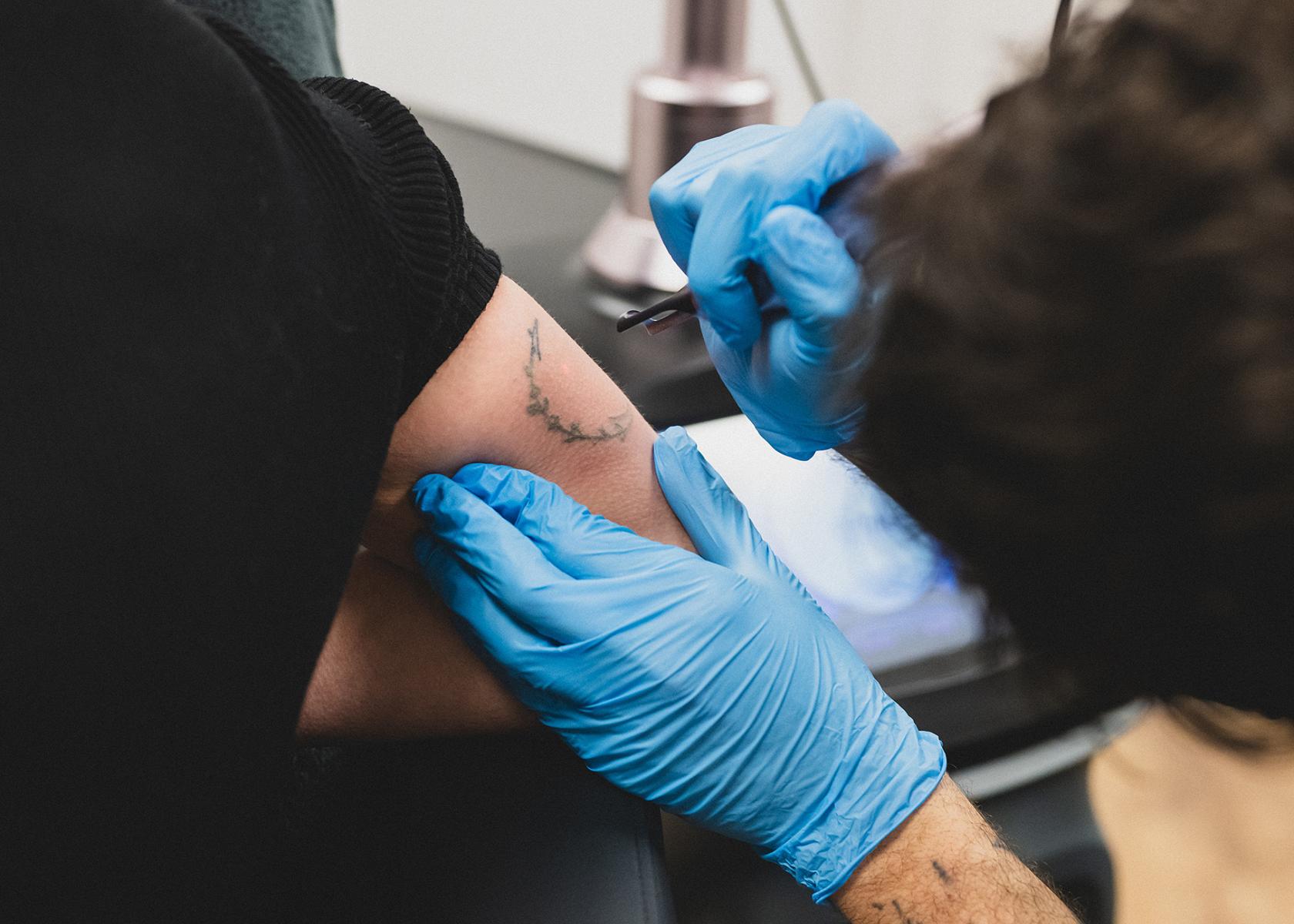 li8 3640 lilian fotografie second skin tattoo remolval leiden daan 2026 02 02