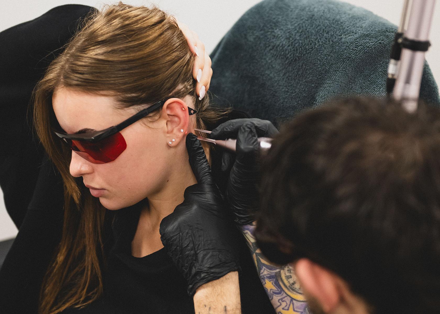 li8 3836 lilian fotografie second skin tattoo remolval leiden daan 2026 02 02