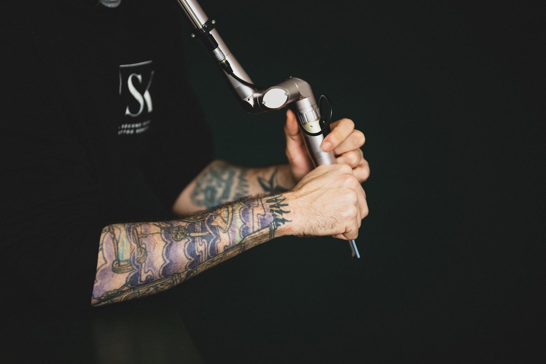 li8 3777 lilian fotografie second skin tattoo remolval leiden daan 2026 02 02