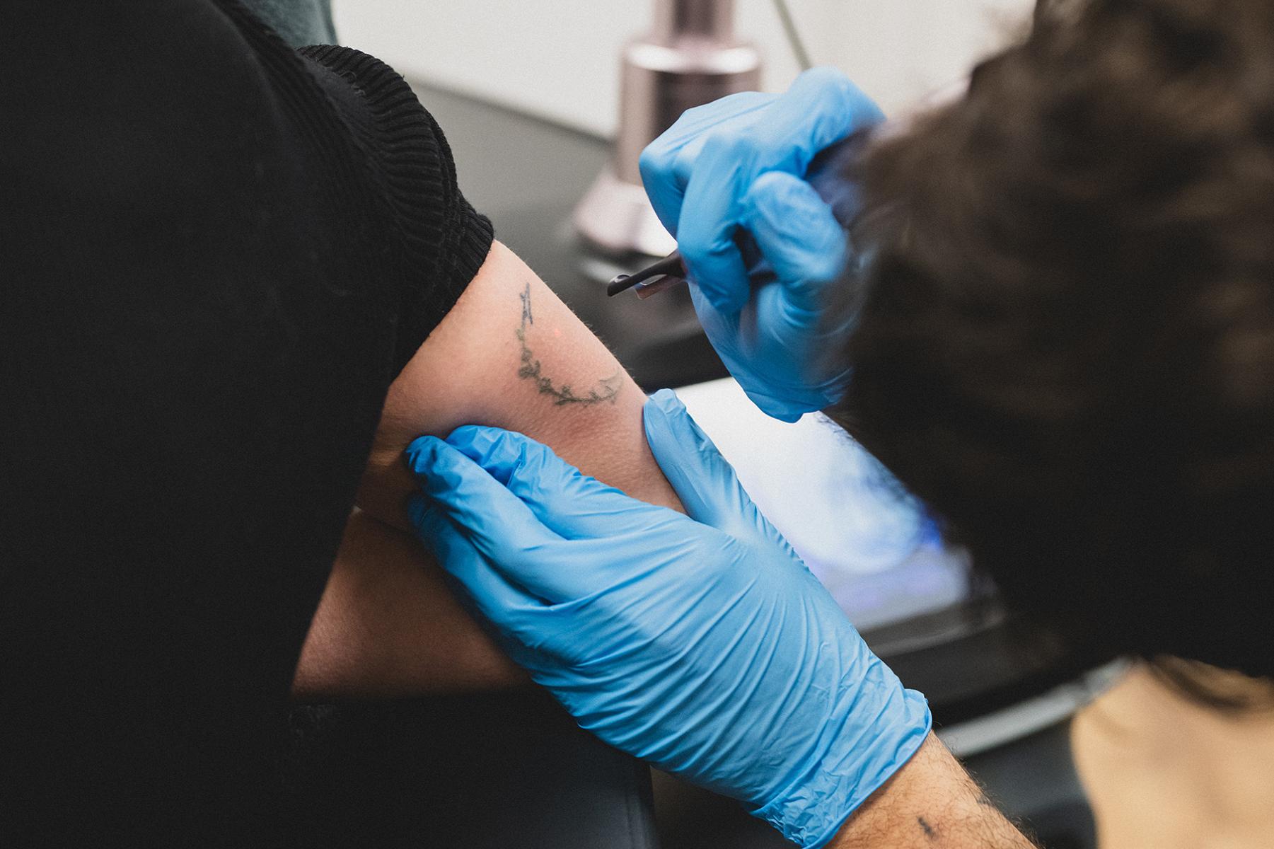 li8 3640 lilian fotografie second skin tattoo remolval leiden daan 2026 02 02